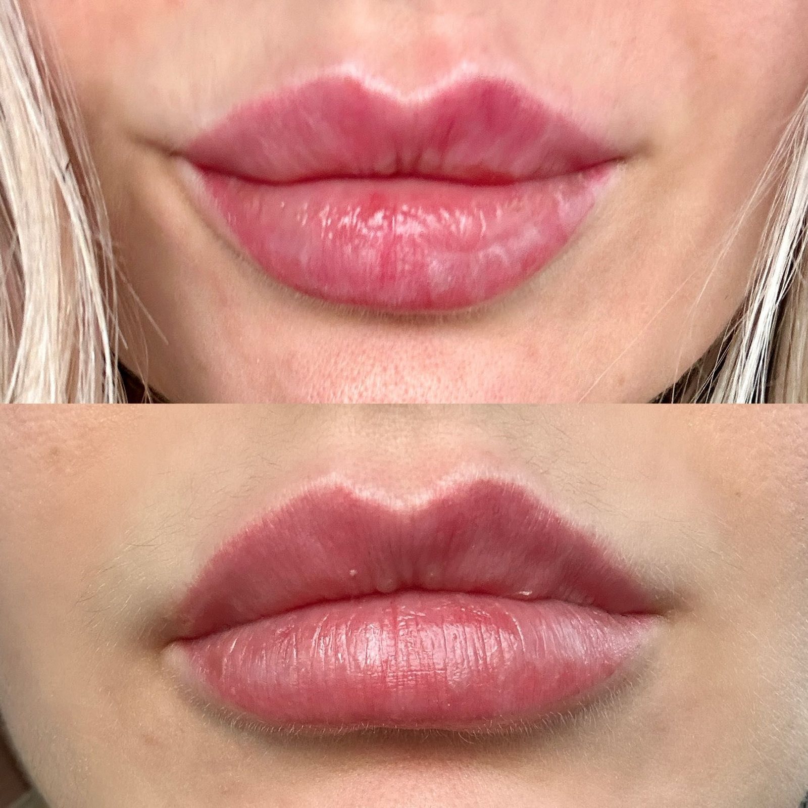 Usta po modelowaniu Natural Lips